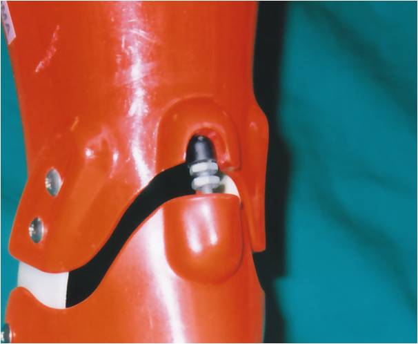 xbJ[ 795