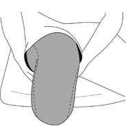 AvX ELPX